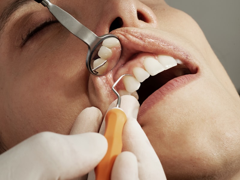 Veneer, Bleaching, atau Clear Aligner? Panduan Memilih Perawatan Estetika Gigi yang Tepat